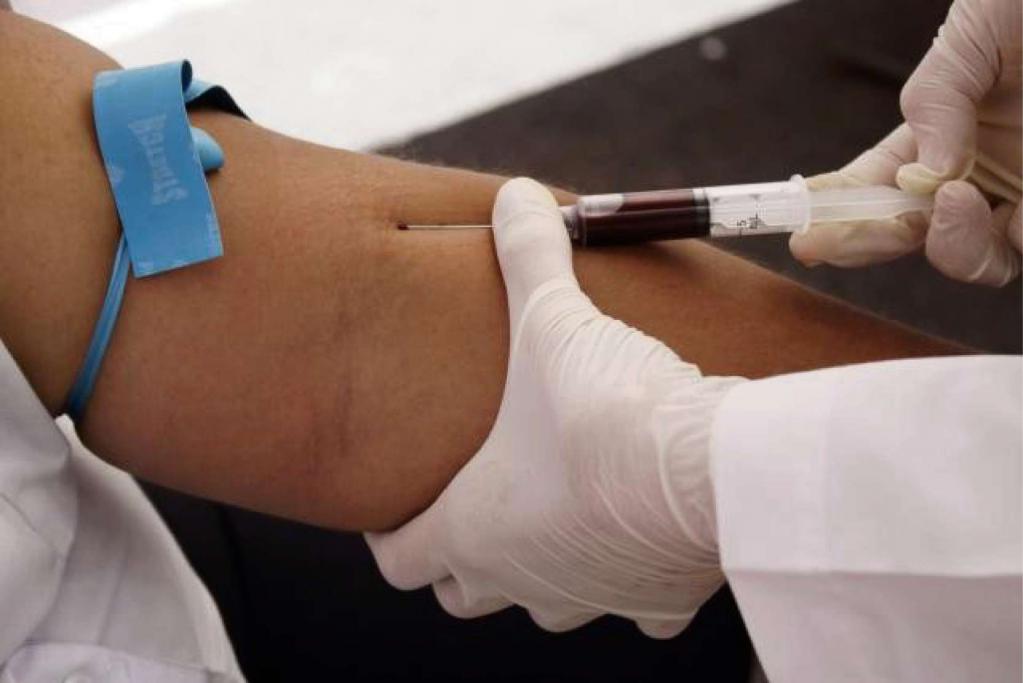 Анализ крови на вирус подготовка thumbnail
