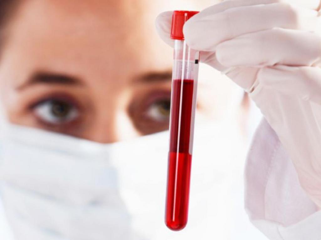 Какой анализ крови определяет вид вируса thumbnail