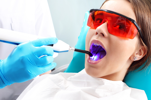 лазерное лечение зубов