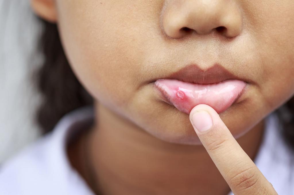 пузырьки на полости рта у ребенка