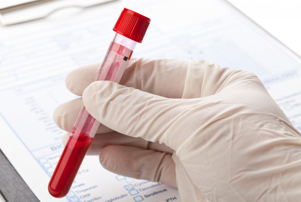 Биохимический анализ крови повышенный хлорид thumbnail