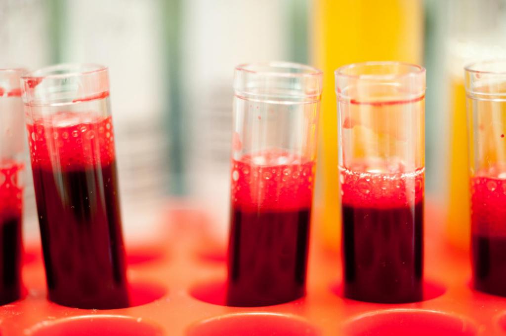 Как по анализу крови определить снижение иммунитета thumbnail