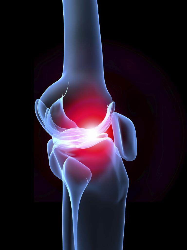 Истончение гиалинового хряща коленного сустава причины лечение thumbnail