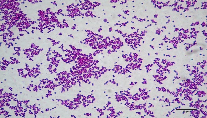 Что такое бактериологическое исследование кала на кишечные инфекции thumbnail