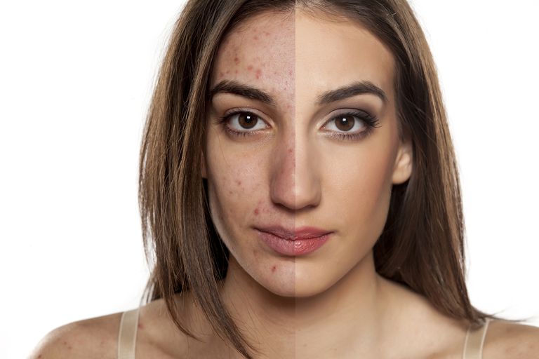 Последствия макияж некачественной косметикой