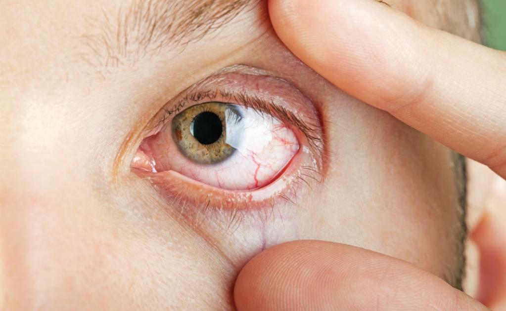 Симптомы ранения глаза