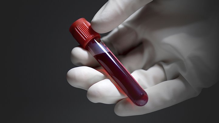 Сбор крови для проверки