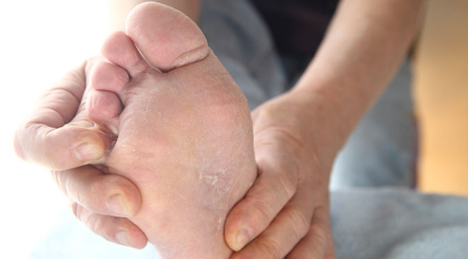 Цыпки на ногах у ребенка лечение thumbnail