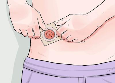 резекция толстого кишечника
