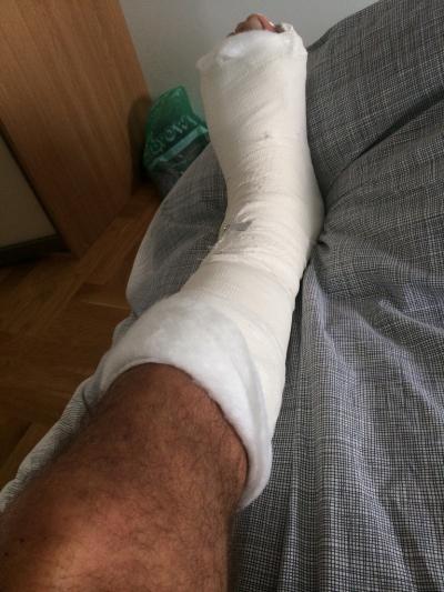 долго ли болит нога после операции thumbnail