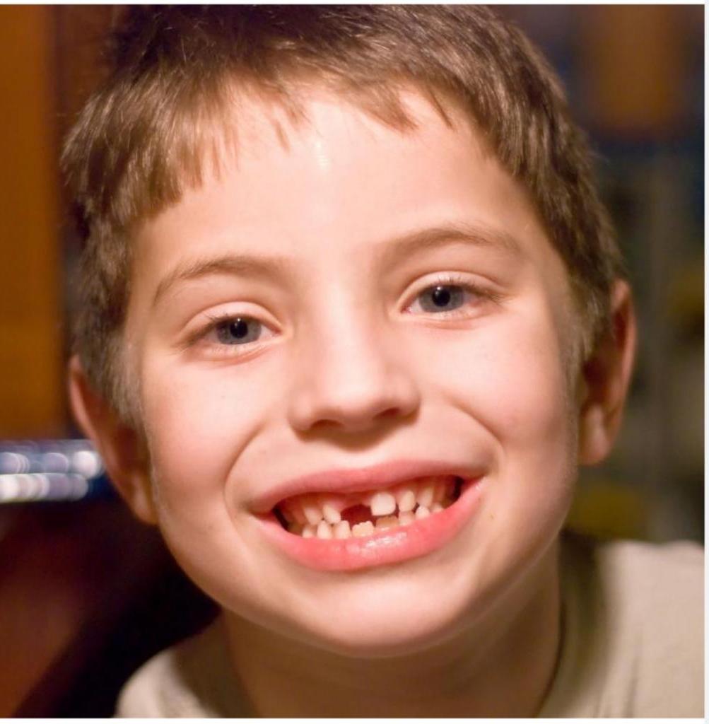 Ребенок без молочных зубов