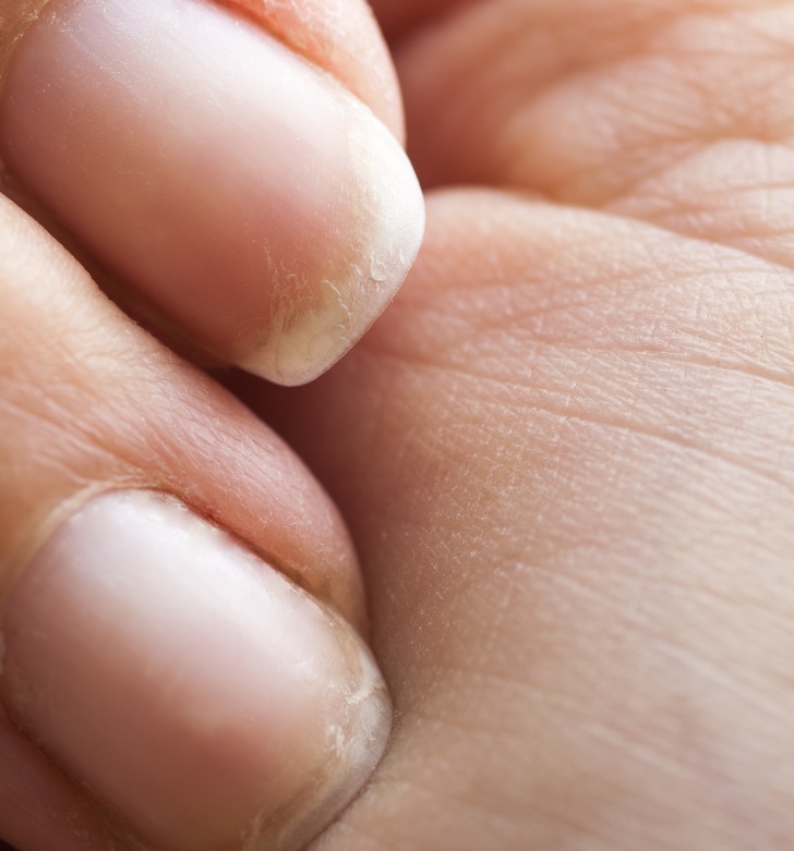Витамины для волос и ногтей если ногти слоятся