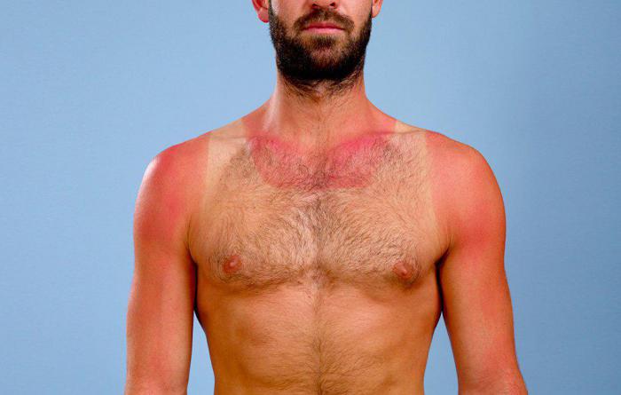 Как защищает себя кожа от солнечного ожога thumbnail