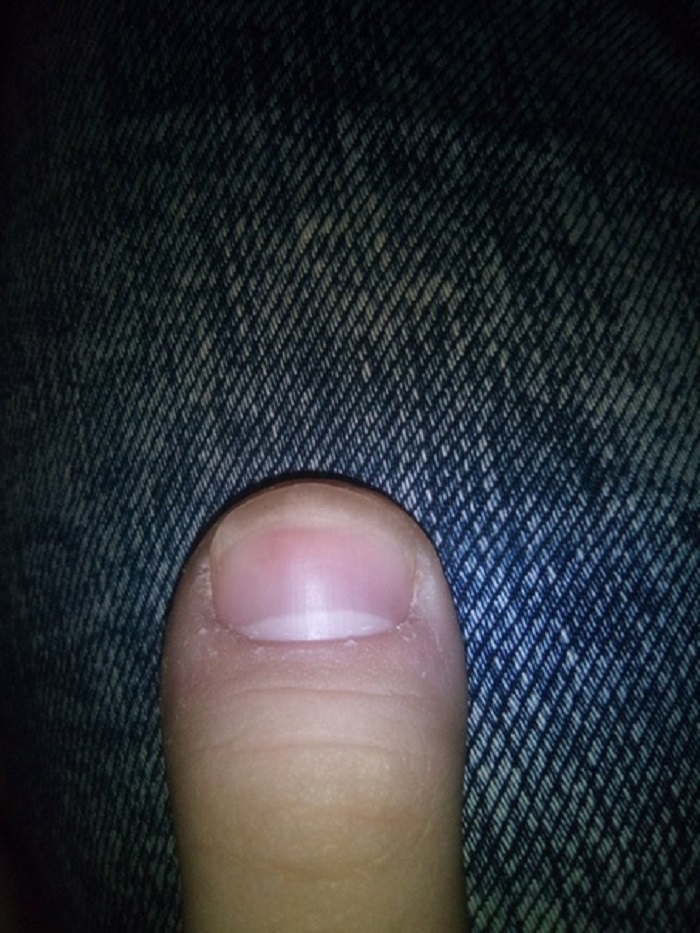 Большой палец изгиб