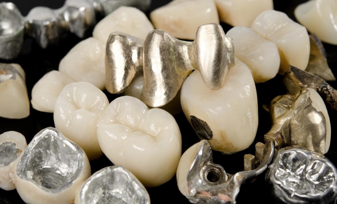 Металлы и сплавы для стоматологии
