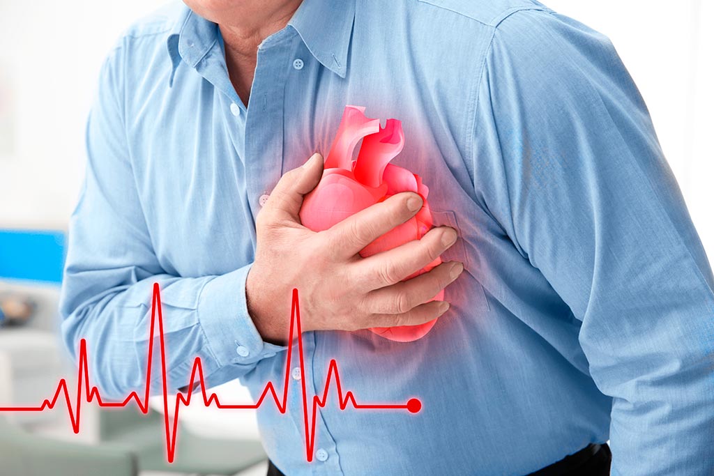 Восстановительное лечение и профилактика инфаркта