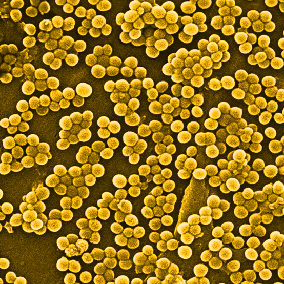 Микробы и бактерии