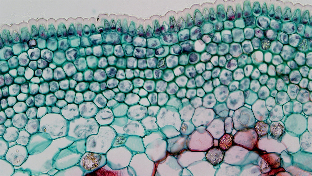 Растительная клетка хитин. Ксилема микроскоп. Покровная — кожица листа под микроскопом. Микропрепарат листа герани. Кортекс растения под микроскопом.