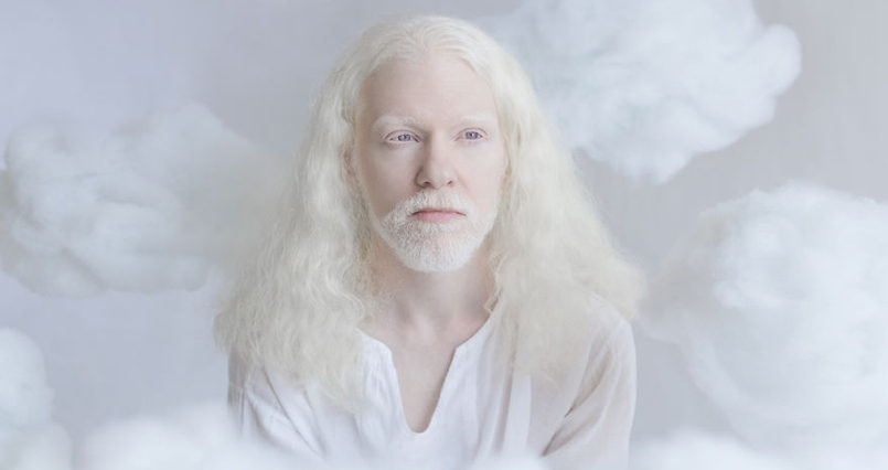 Парень альбинос с длинными волосами