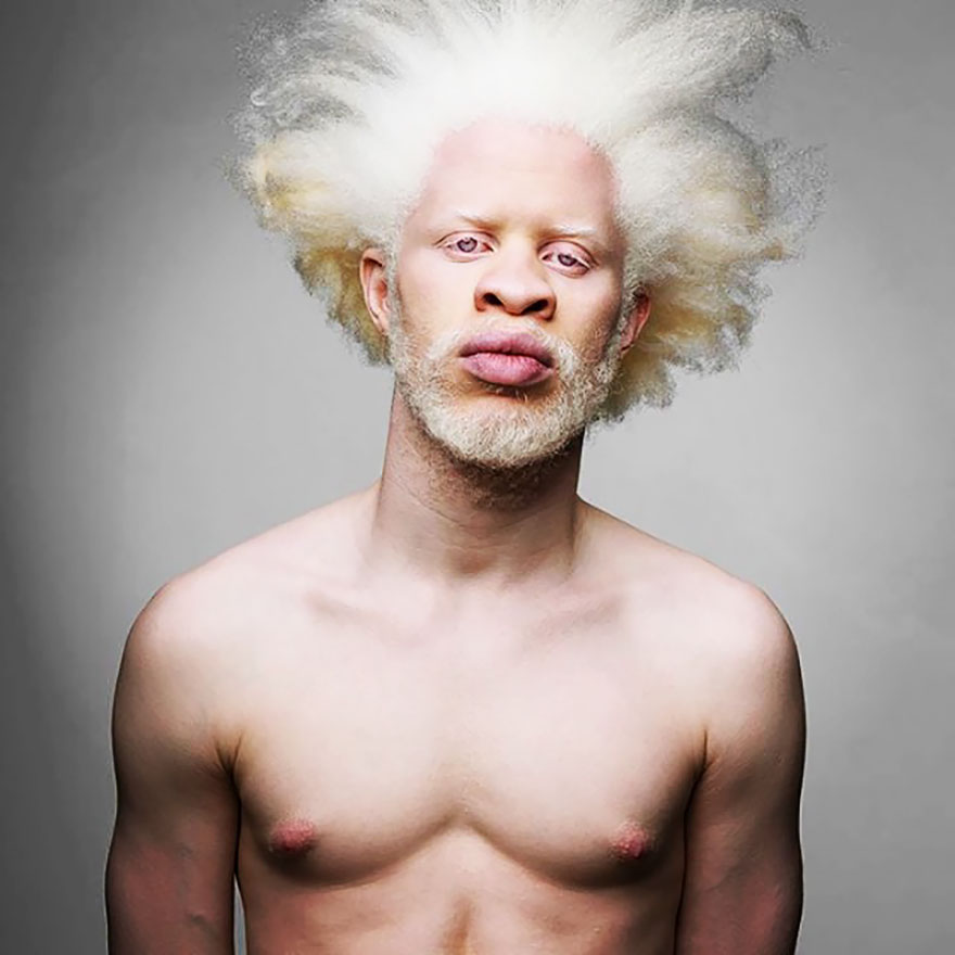 Модель альбинос