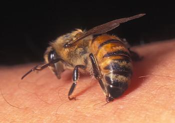 К чему снится укус пчелы