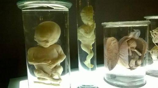 Анатомическая выставка тело человека спб