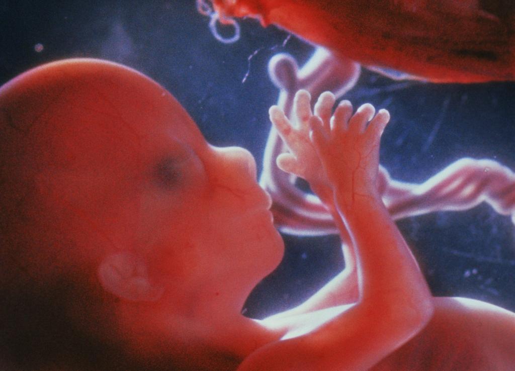 15 акушерских недель. Перезачатие. How does the fetus look like on week 9.