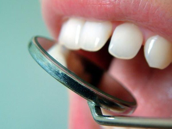При удалении нерва из зуба могут ли болеть соседние зубы thumbnail