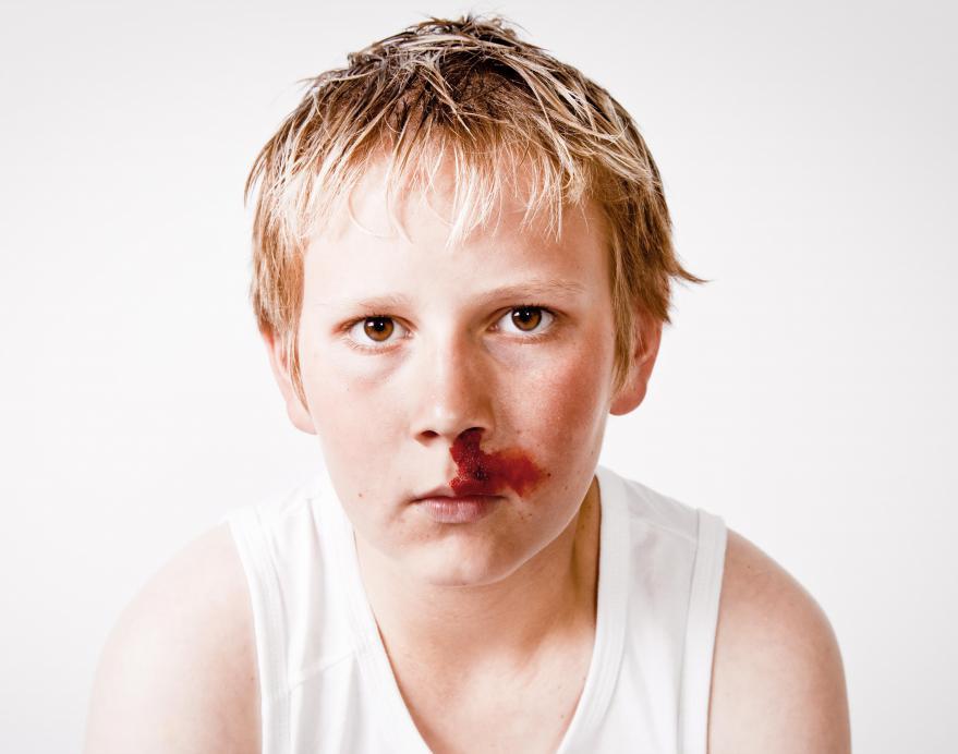 почему у подростков идет кровь из носа