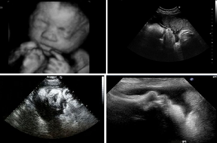 36 недель беременности фото ребенка в утробе