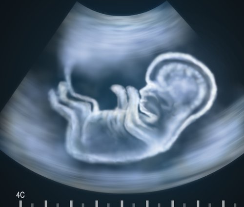 ultrasound image