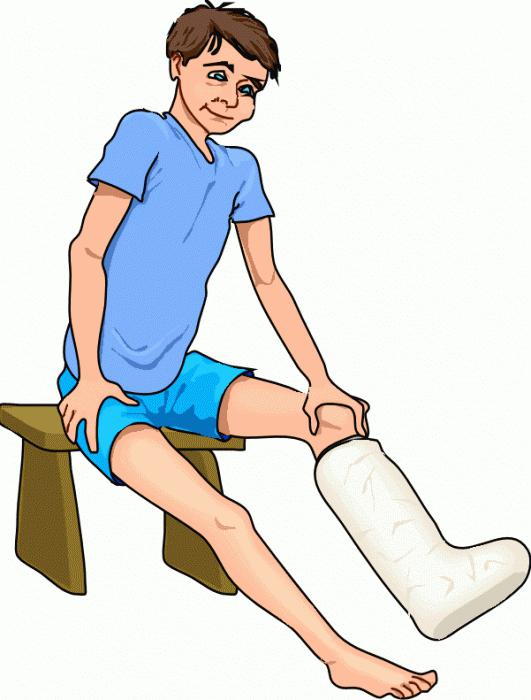 признаки перелома ноги