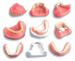 протезирование зубов виды протезов