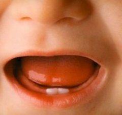 симптомы режущихся зубов у детей