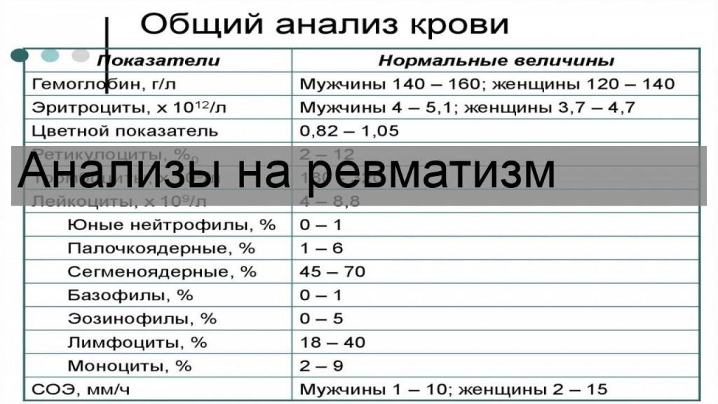 анализы на ревматизм