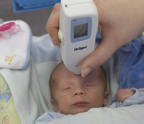 Bilirubin level measurement