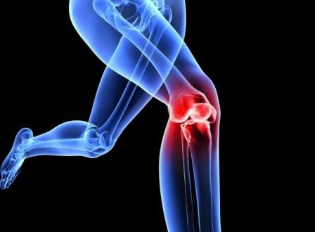 лечебная физкультура при артрозе коленного сустава