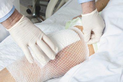 seam care after surgery