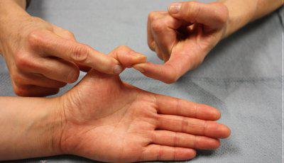 стенозирующий лигаментит большого пальца 