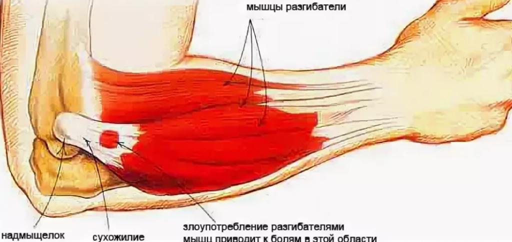 мышцы локтевого сустава 