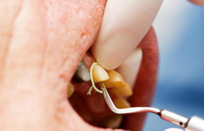 стоимость лечения зубов 