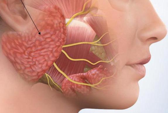 sialadenitis in children treatment