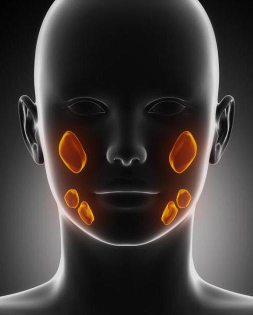 sialadenitis of the parotid salivary gland treatment