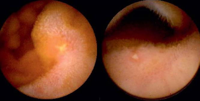 where to do capsule endoscopy