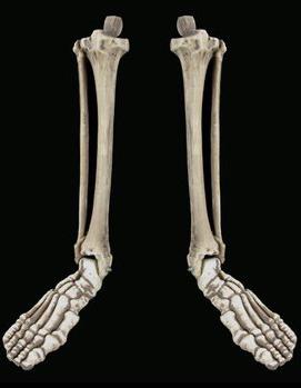 кости нижних конечностей 