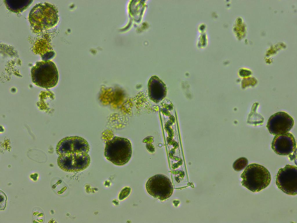 Microscope and Phytoplankton