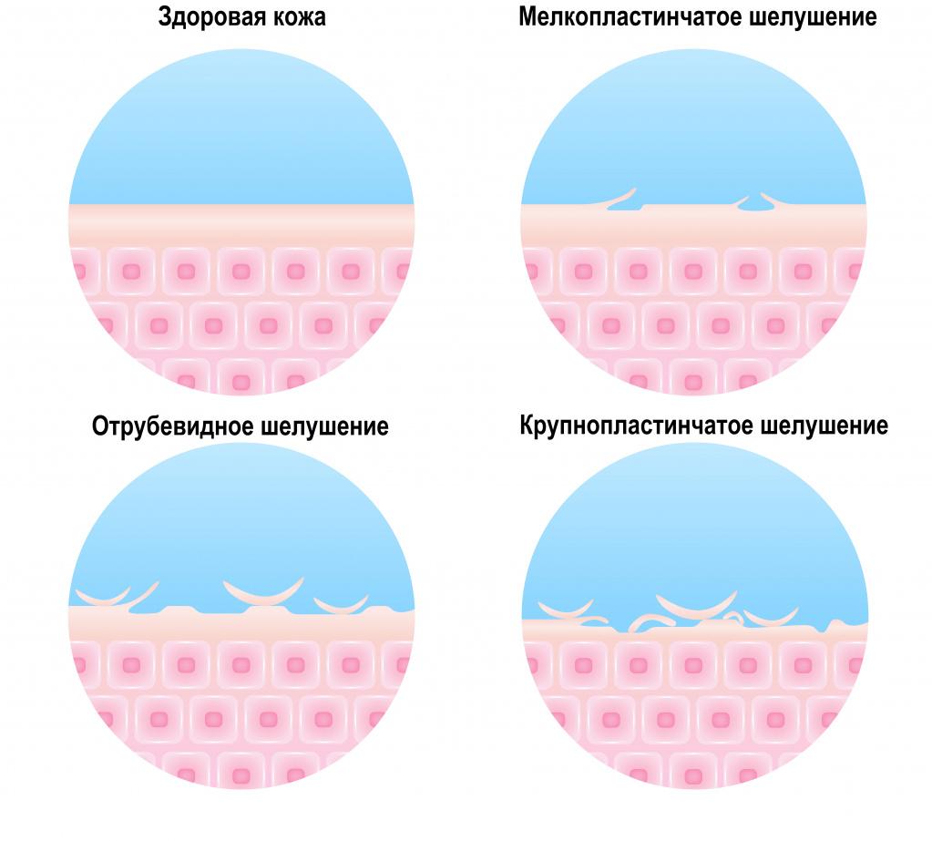 Рисунок шалушая