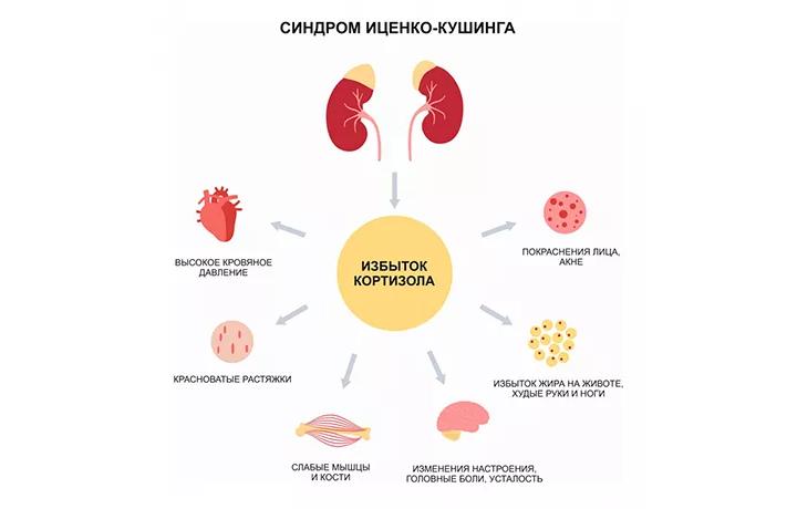 синдром иценко кушинга