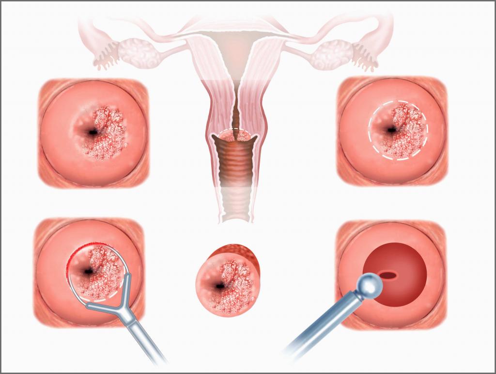 different condition of the cervix