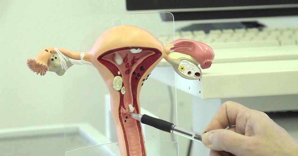 pathology of the cervix